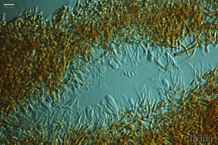 3) Preso su vecchio tronco di Pino il 22.02.2013.